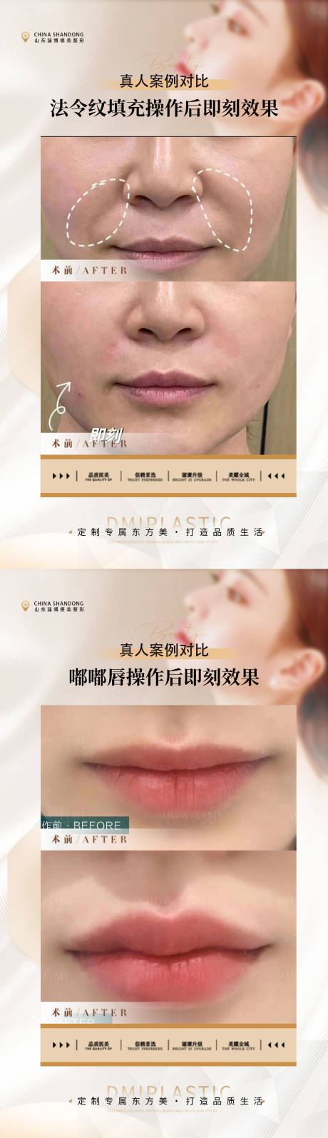 源文件下载【医美整形案例海报】编号：15420018992859408