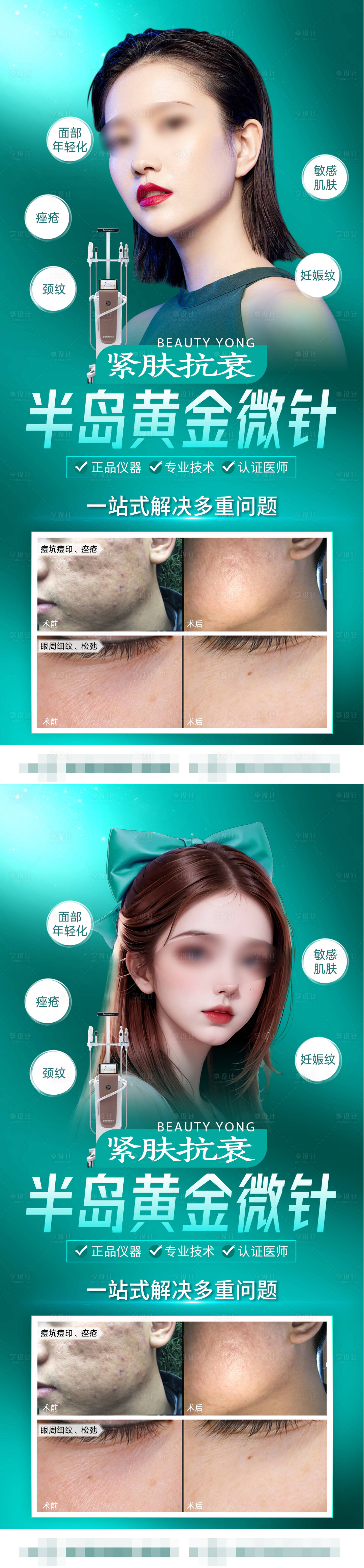 源文件下载【医美黄金微针体验案例海报】编号：22890018798464177