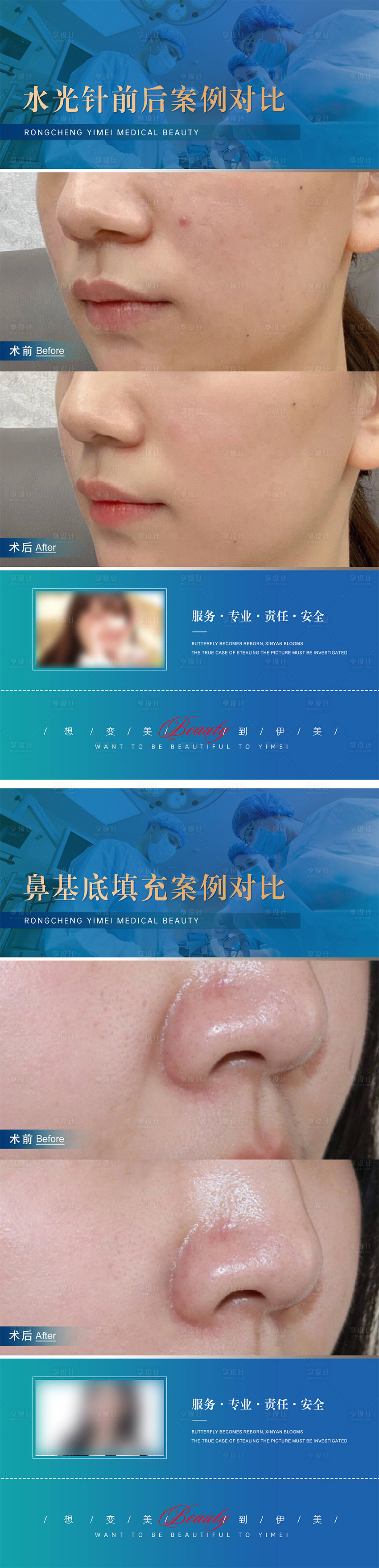 源文件下載【享設計】搜索編號：60840018965048998【醫美案例對比系列海報】