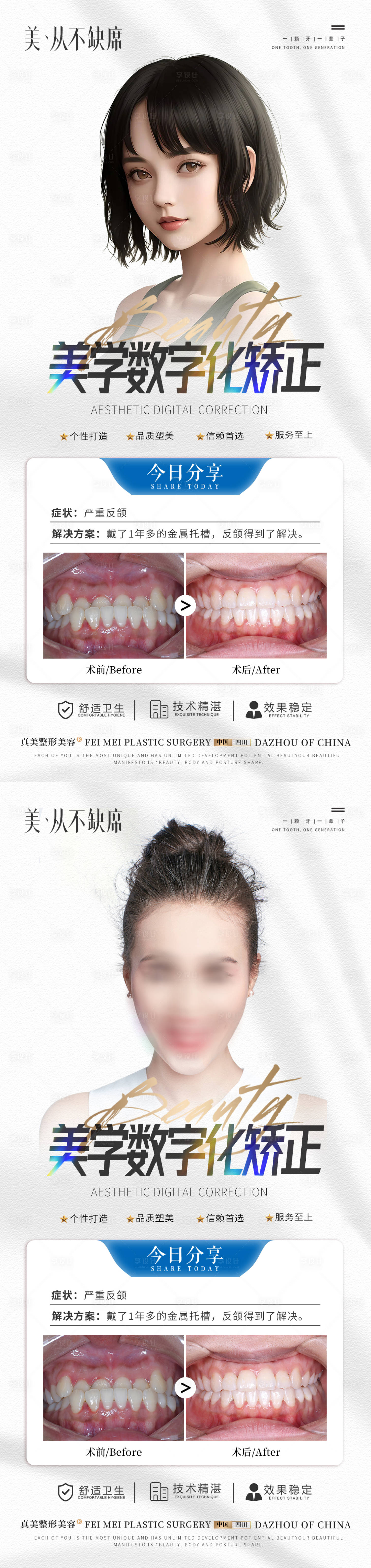 源文件下载【口腔美学数字矫正案例海报】编号：53840018784441037