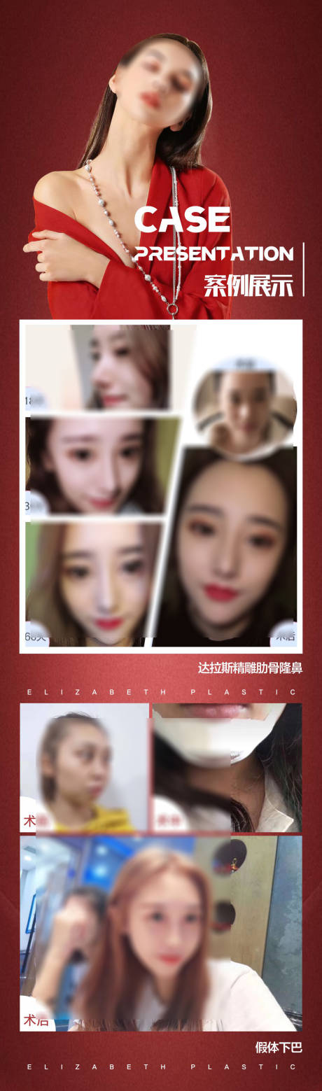 源文件下载【医美案例集】编号：44220018844883834