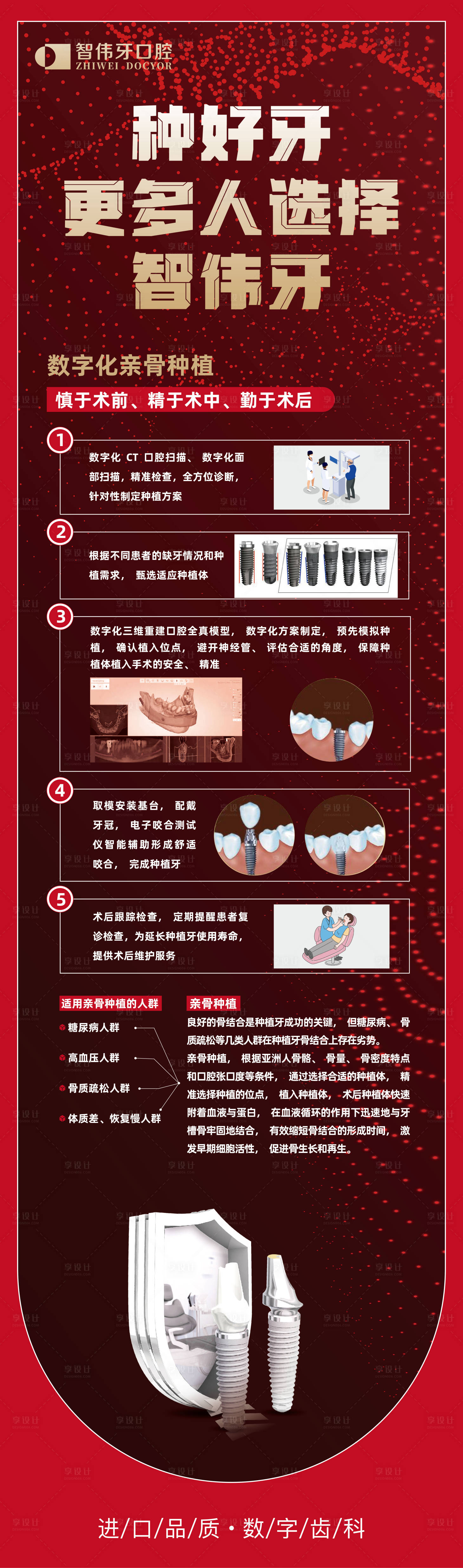 源文件下载【数字化亲骨种植 】编号：35520018763352322