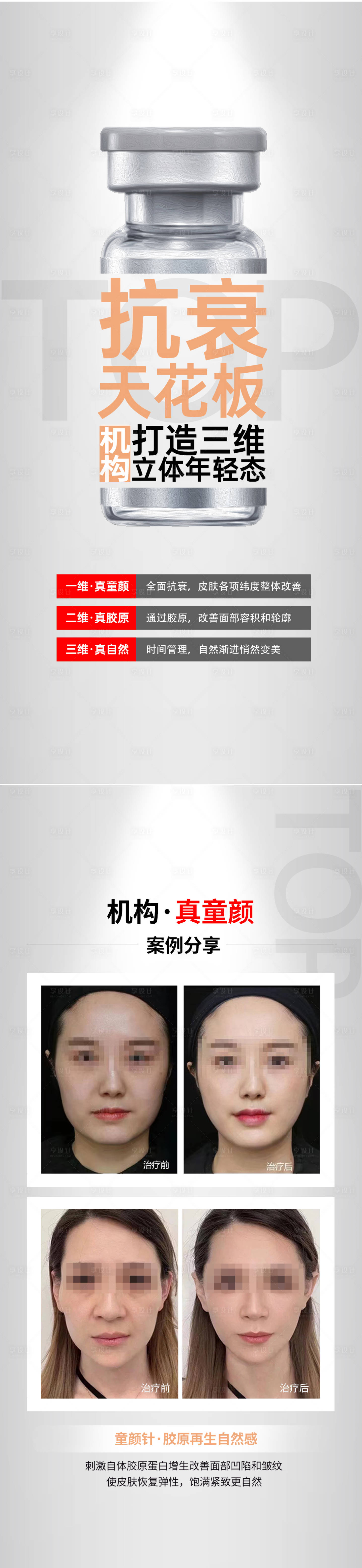 源文件下載【享設(shè)計】搜索編號：40560018441647001【醫(yī)美艾維嵐膠原蛋白海報】