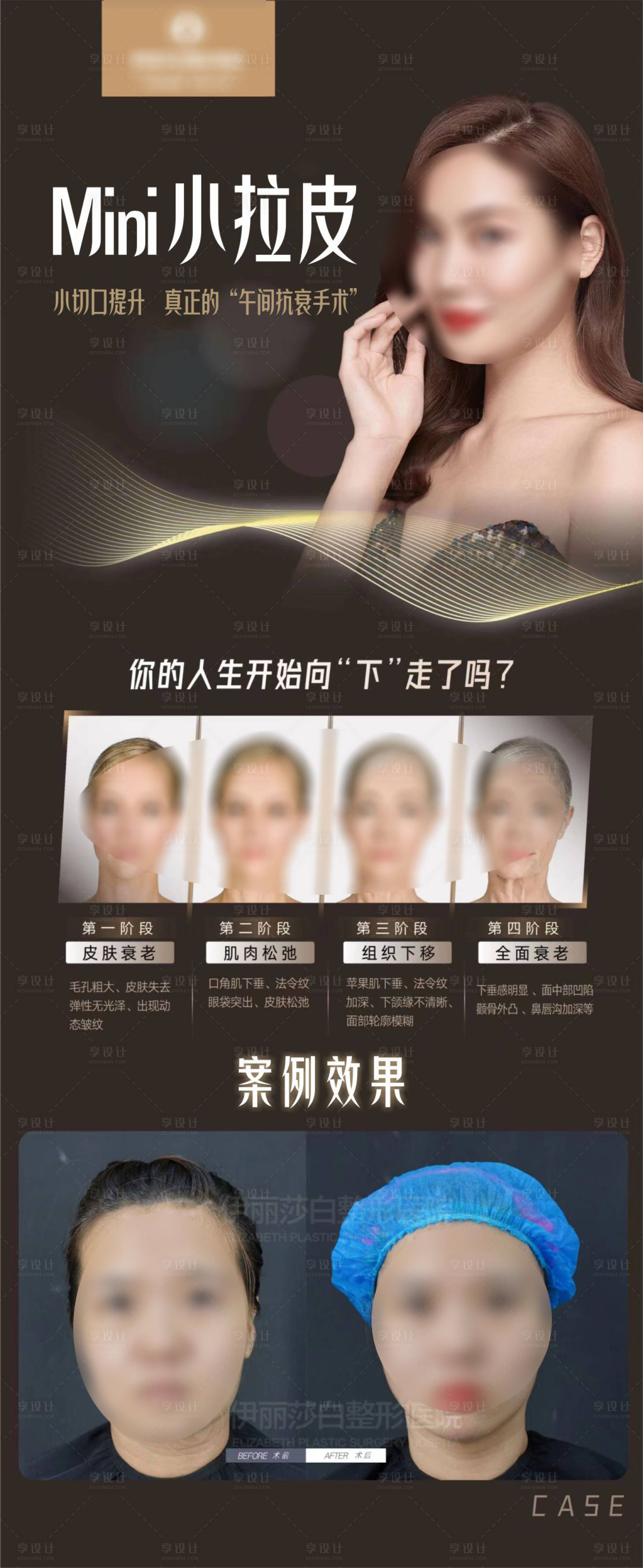 源文件下載【享設(shè)計(jì)】搜索編號：76150018792084071【醫(yī)美小拉皮案例海報(bào)】