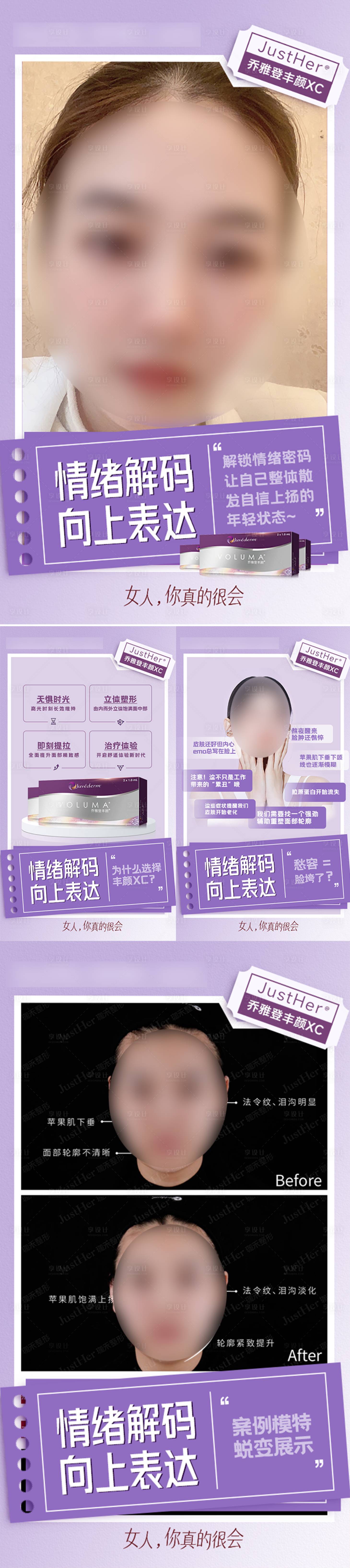 源文件下載【享設(shè)計】搜索編號：72840018881178416【微整案例宣傳圖 】