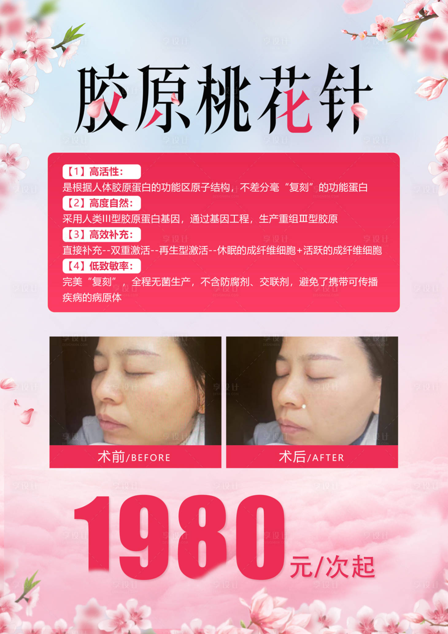 源文件下载【胶原桃花针案例对比海报】编号：20230825161652411