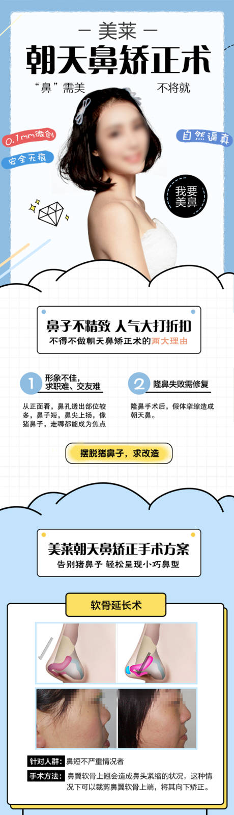 源文件下载【医美朝天鼻矫正术详情页】编号：32140018928034637