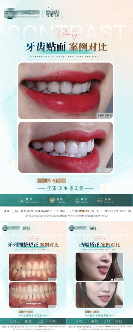 源文件下载【口腔案例对比合集海报】编号：41660018590938333