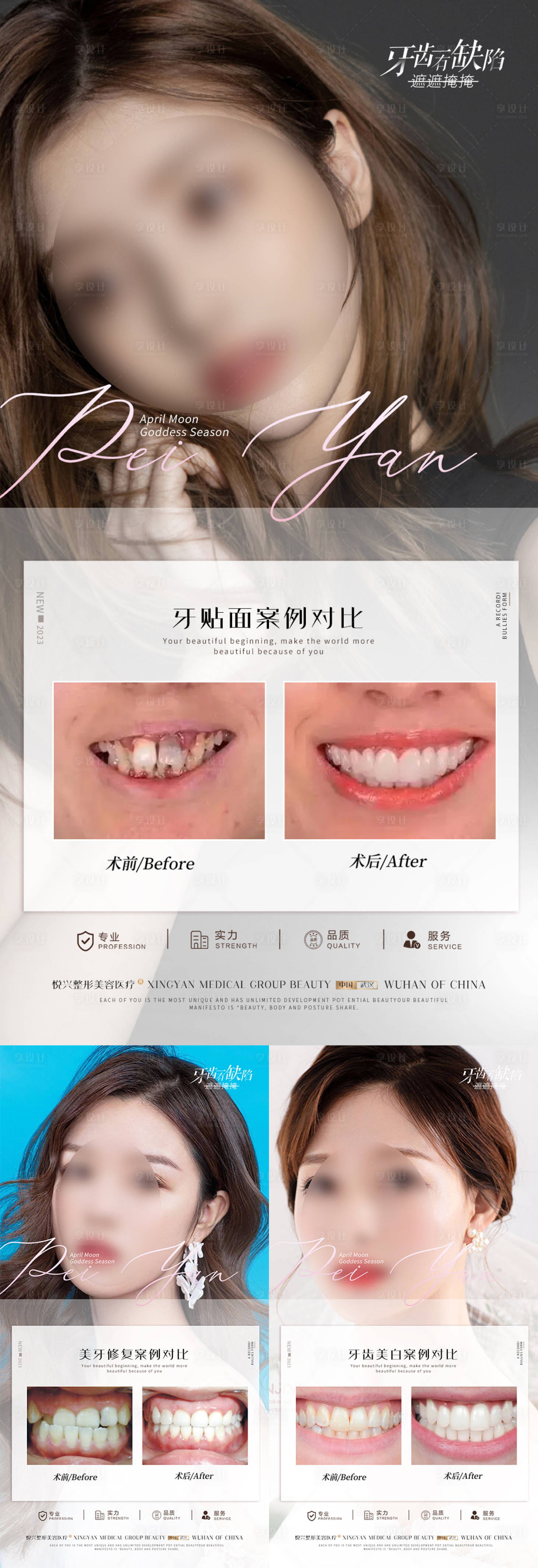 源文件下载【口腔案例】编号：31430018585471397