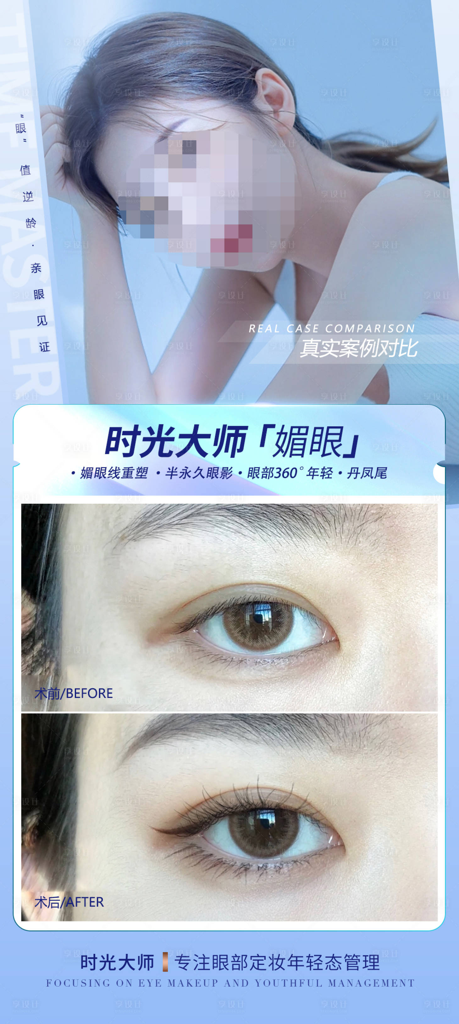 源文件下载【医美案例对比图海报 】编号：45790018665097203