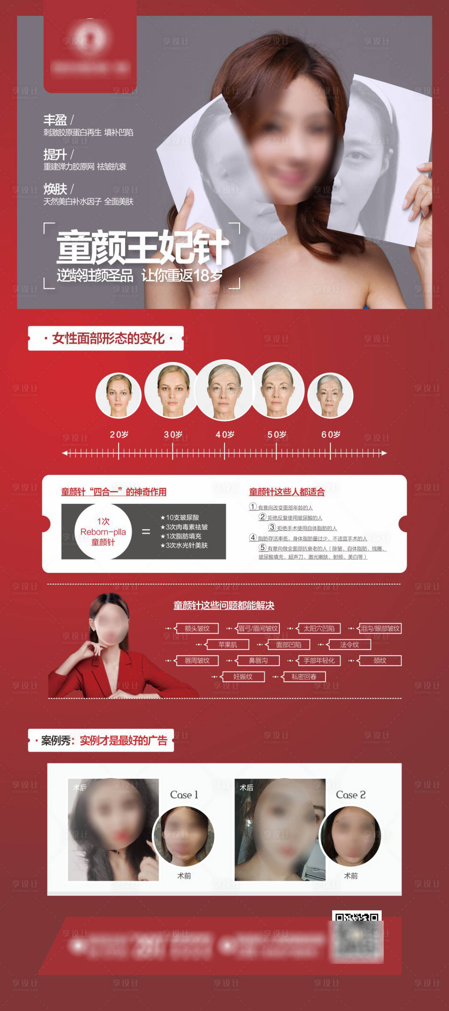 源文件下载【医美童颜针易拉宝】编号：20850018701943708