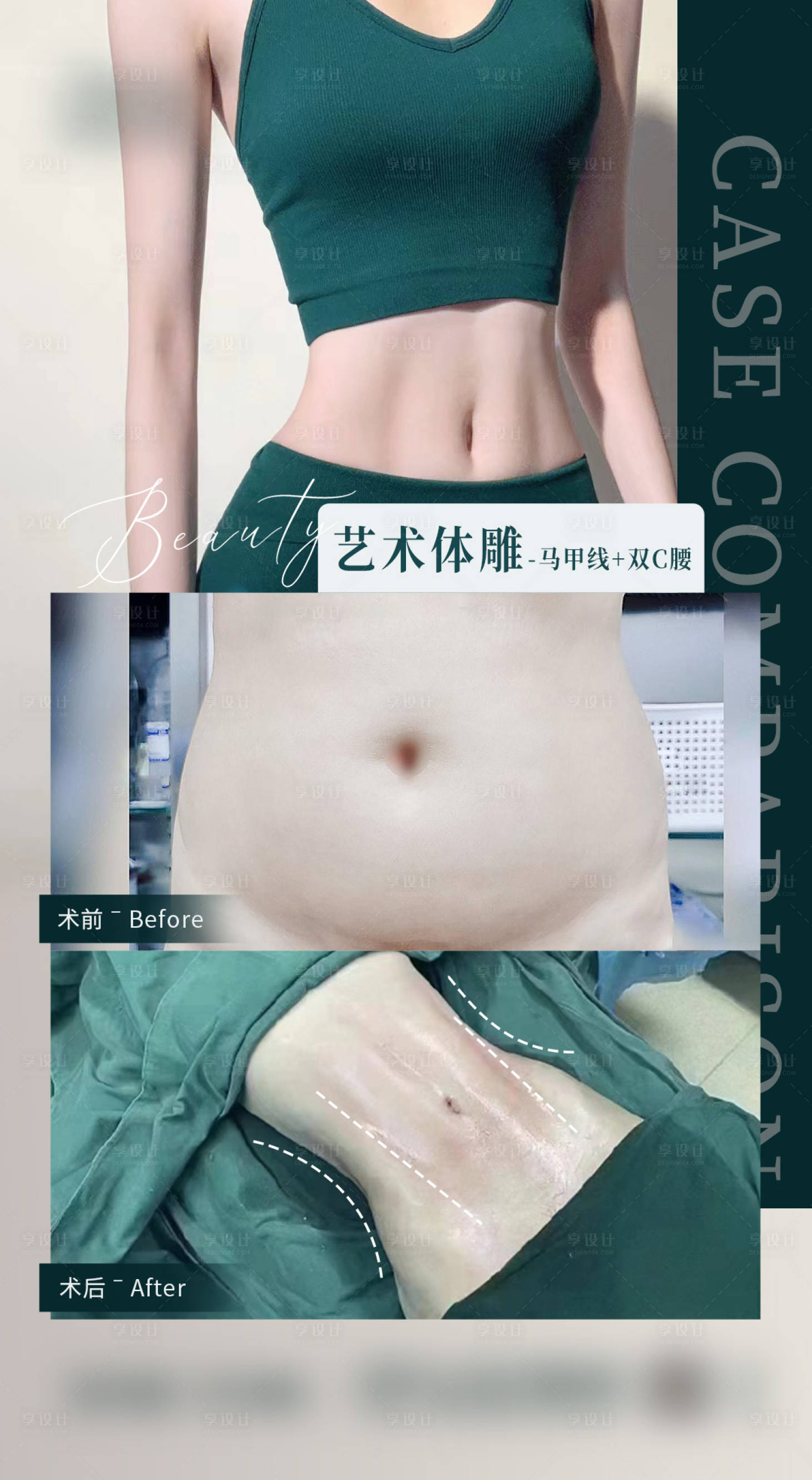 源文件下载【艺术体雕马甲线海报】编号：42510018988515930