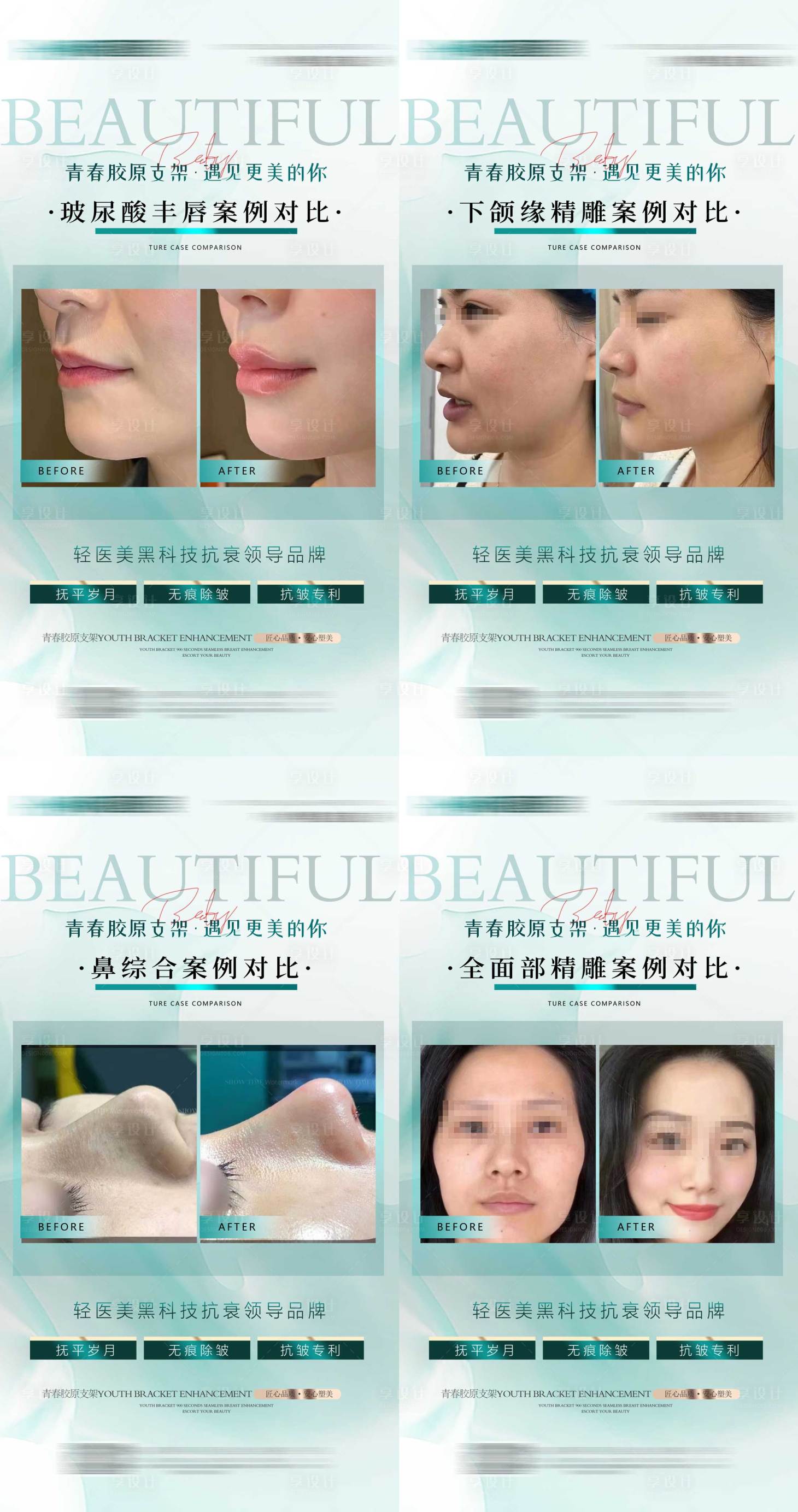 源文件下载【轻医美案例】编号：40450018641339560
