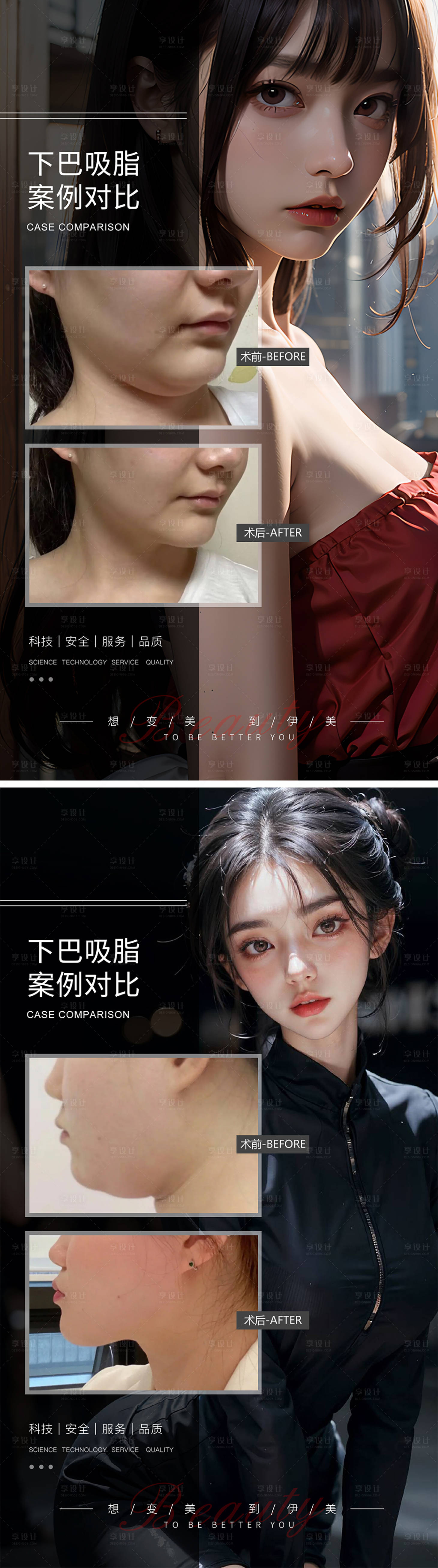 源文件下載【享設計】搜索編號：94560019290554972【下巴吸脂案例對比】