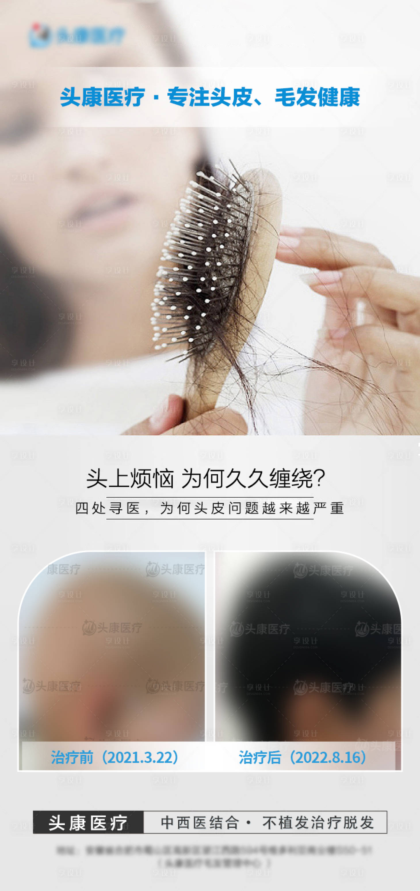 源文件下载【治疗脱发海报】编号：49540019541132616