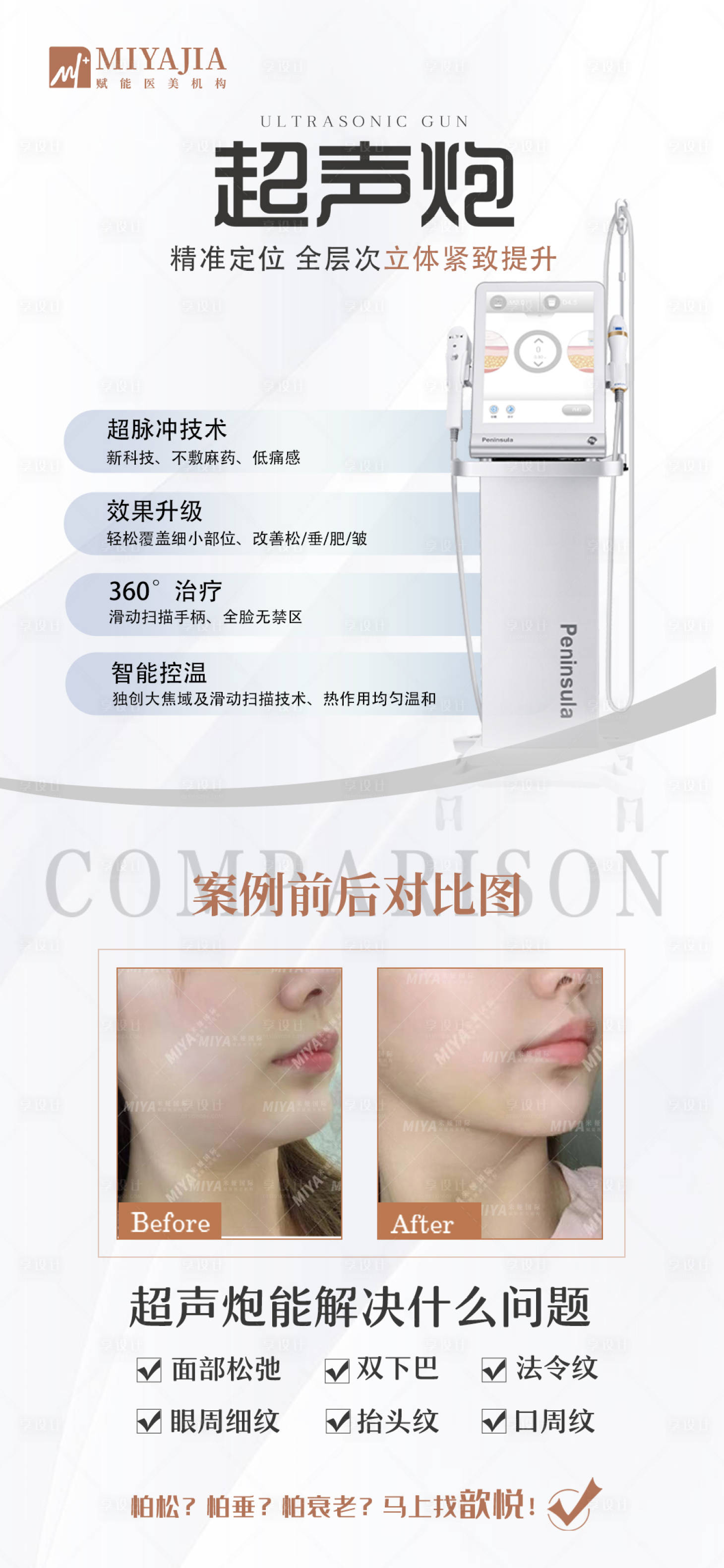 源文件下载【享设计】搜索编号：93490019350367027【医美光电海报】