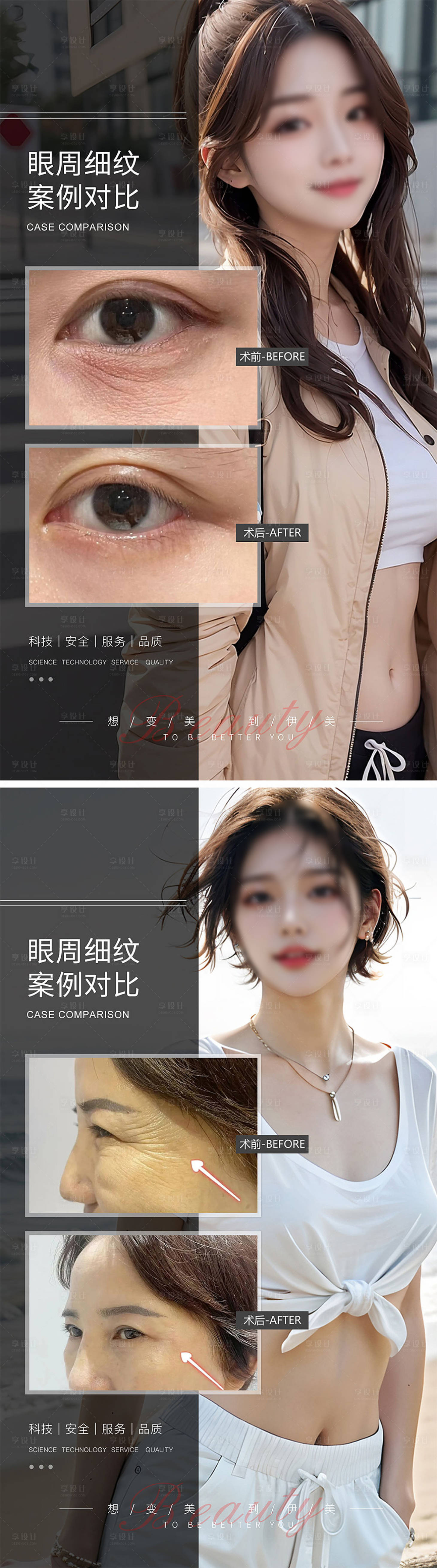 源文件下載【享設(shè)計】搜索編號：91940019252959868【眼周細紋眼周年輕化案例對比海報】