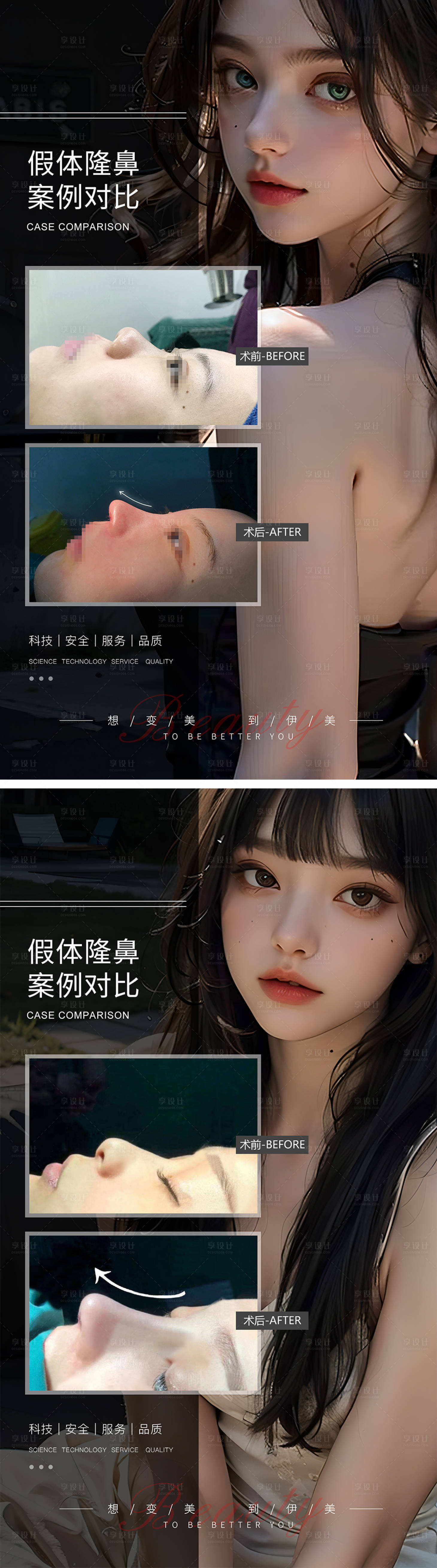 源文件下载【假体隆鼻案例对比】编号：68850019307926068