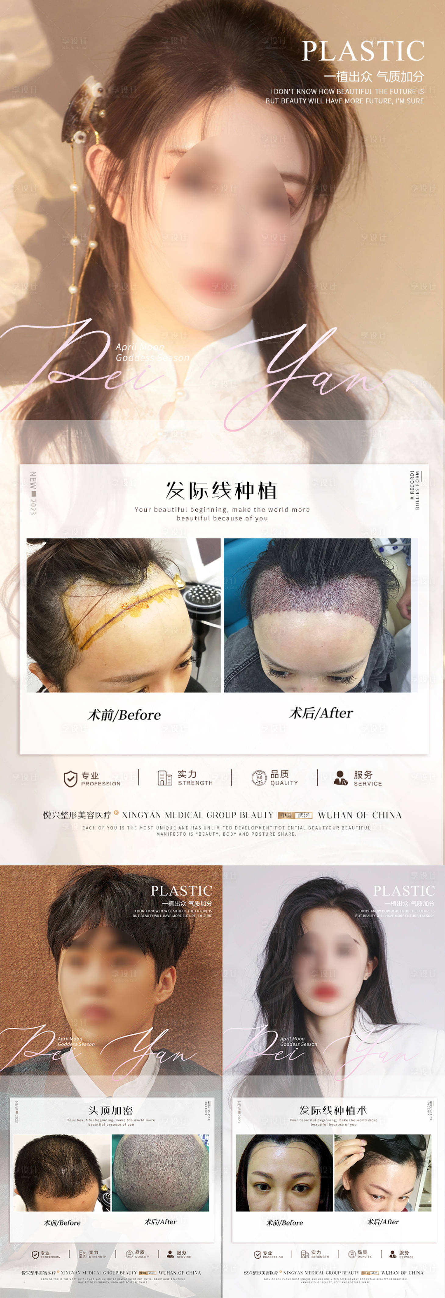 源文件下载【享设计】搜索编号：84050019284887800【植发案例系列海报】