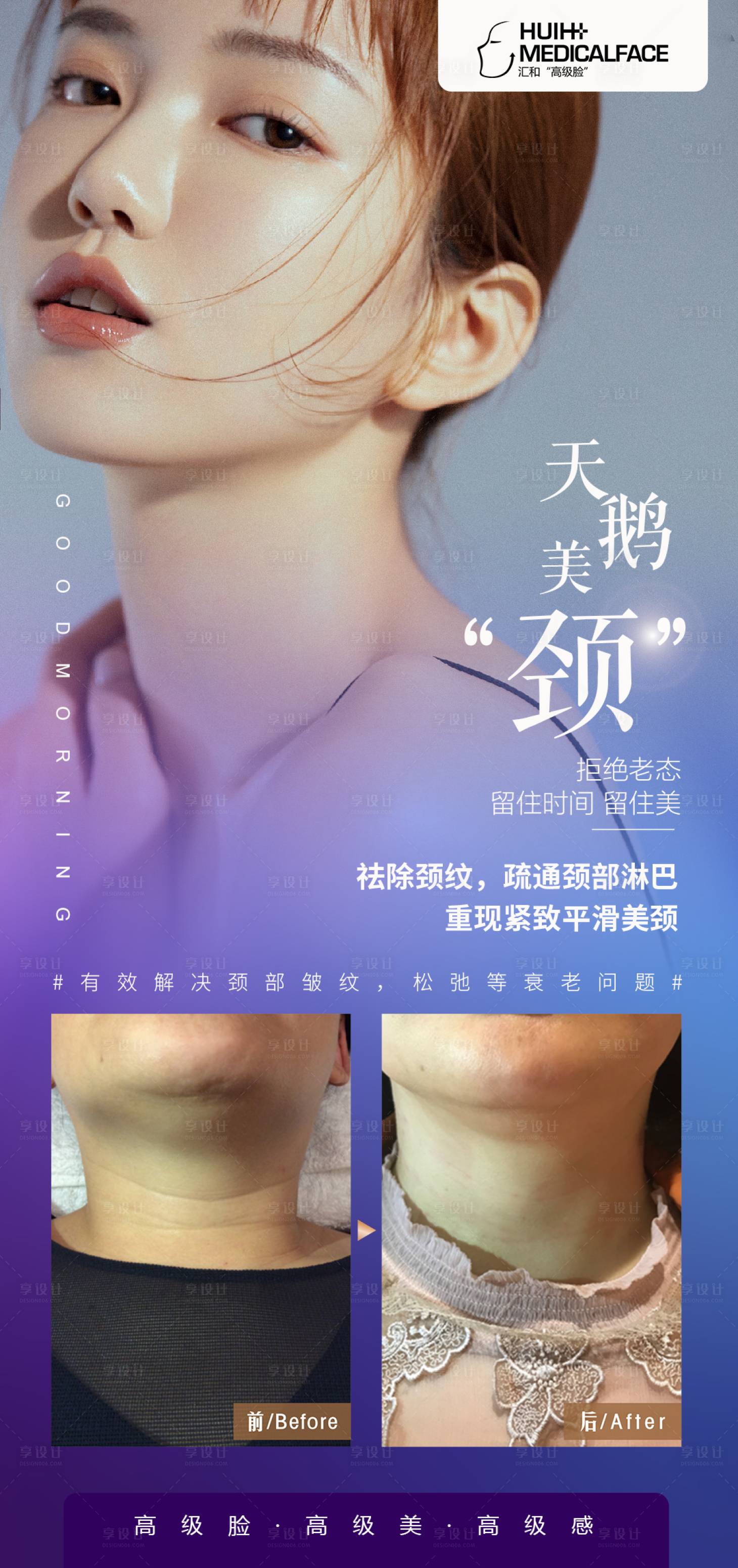 源文件下載【享設計】搜索編號：89030019158237117【醫美祛頸紋】