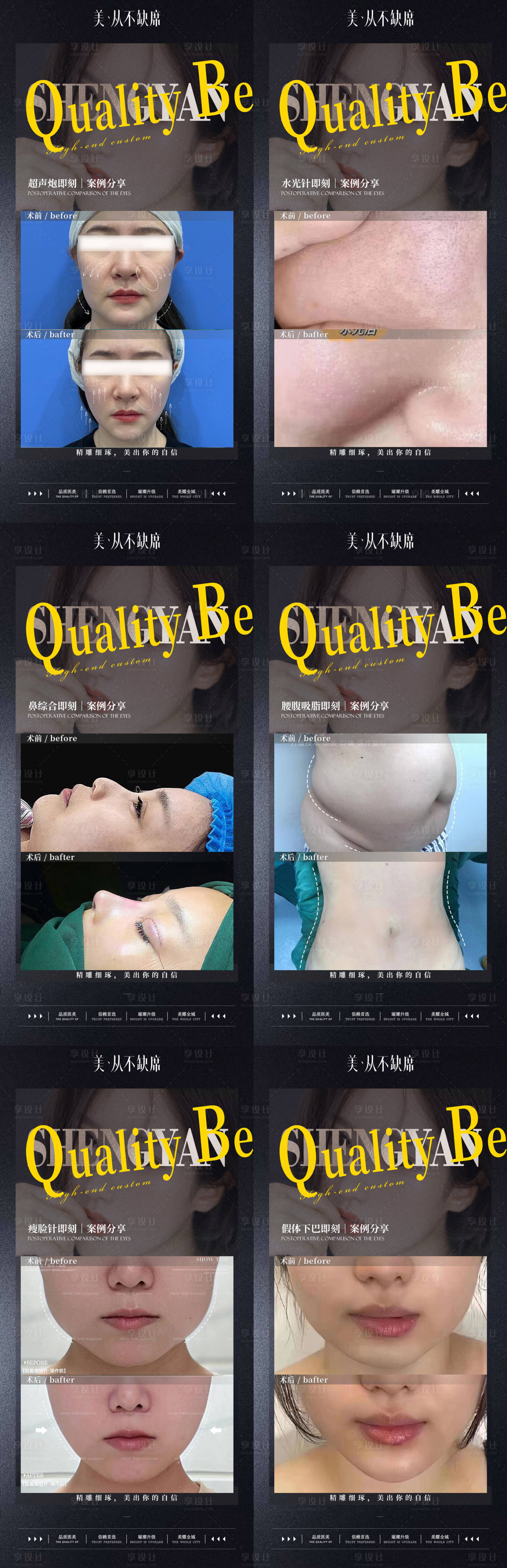 源文件下载【整形黑金案例】编号：54310019085602404