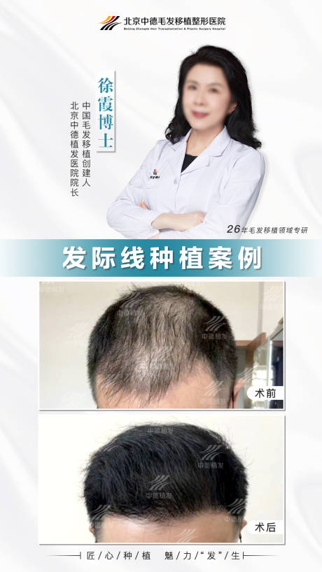 源文件下载【植发真实案例】编号：53340019267955319