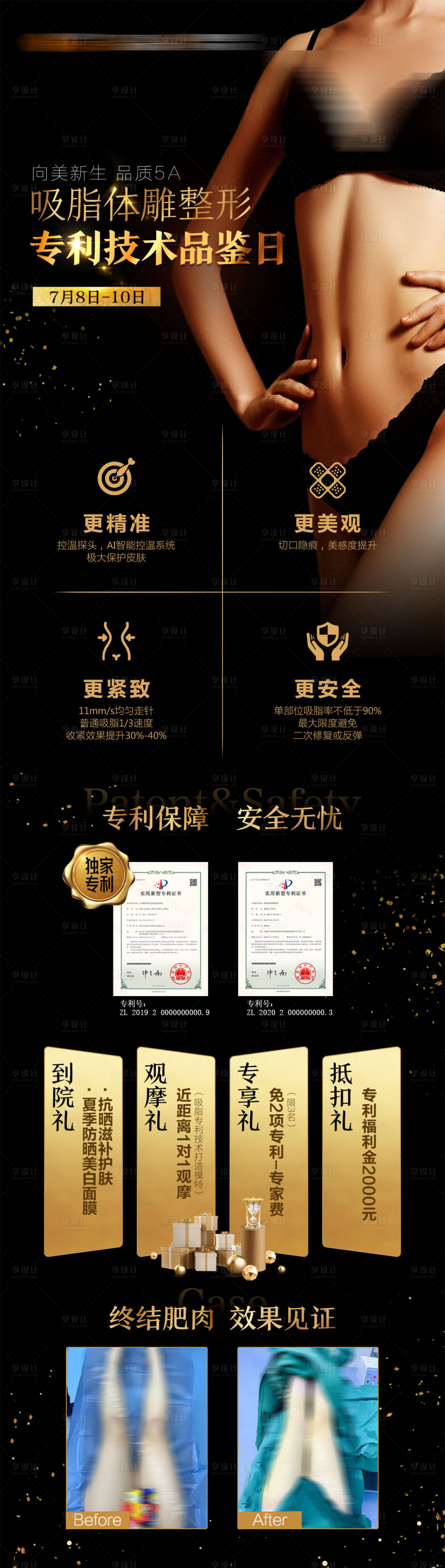 源文件下載【享設計】搜索編號：41340019386154904【水動力吸脂高端黑金風格宣傳長圖海報】
