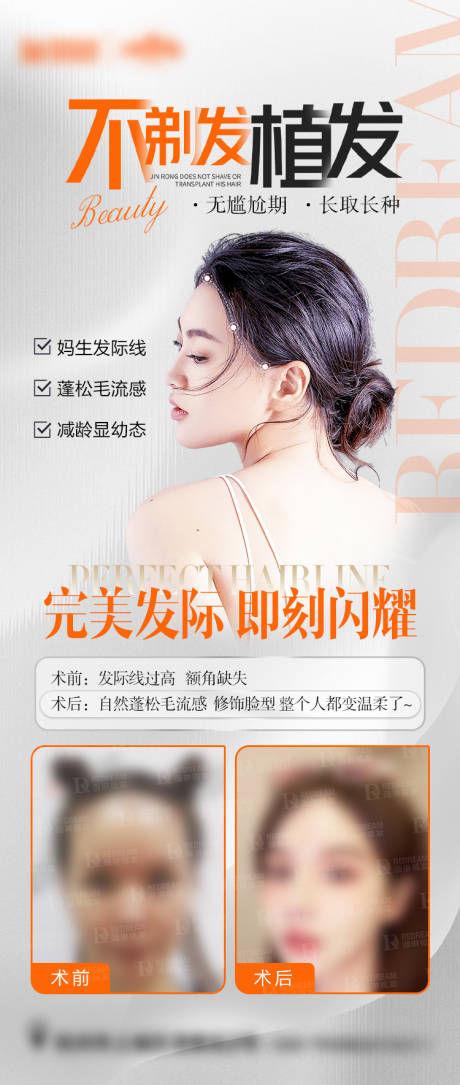 源文件下载【植发】编号：28340019410122401