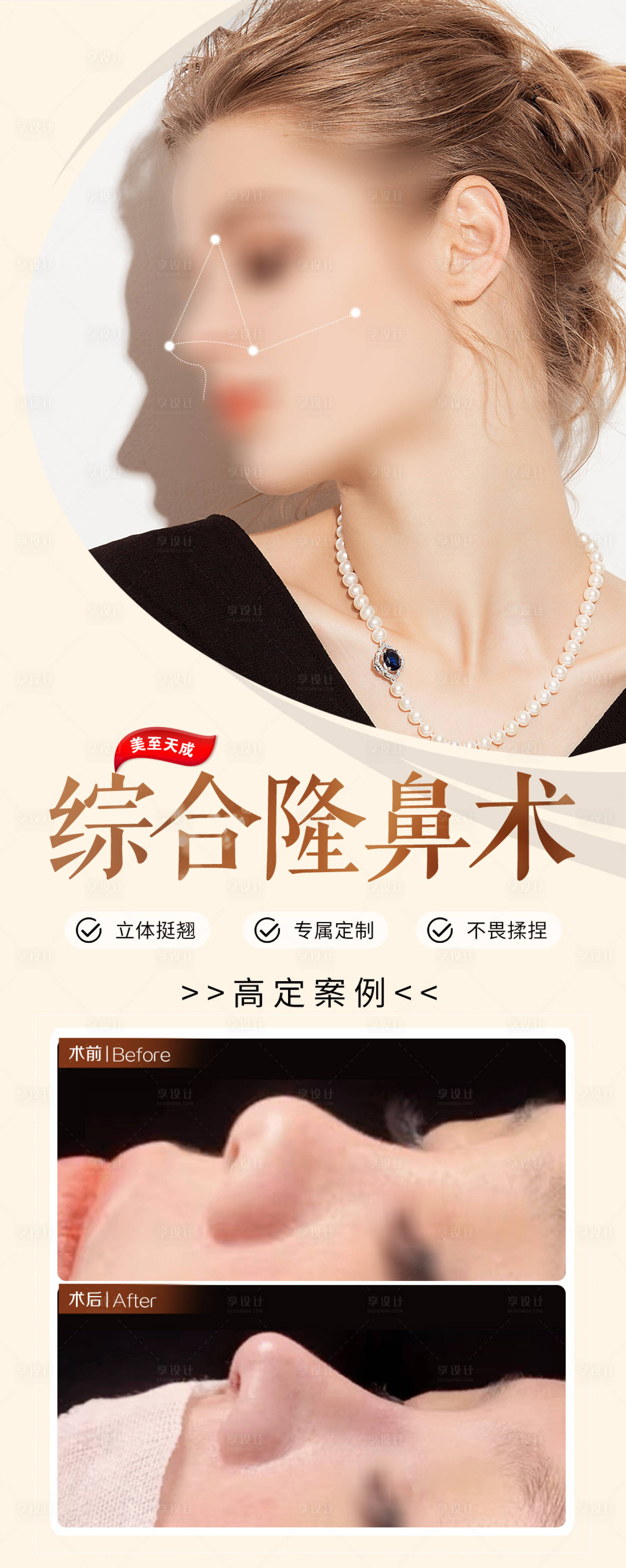源文件下载【享设计】搜索编号：23300019597361036【隆鼻医美整形项目海报】