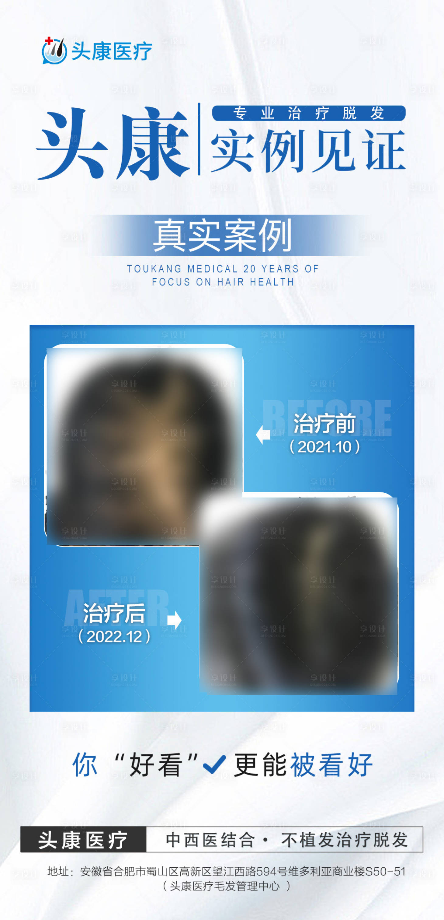 源文件下载【脱发案例】编号：40250019539208321