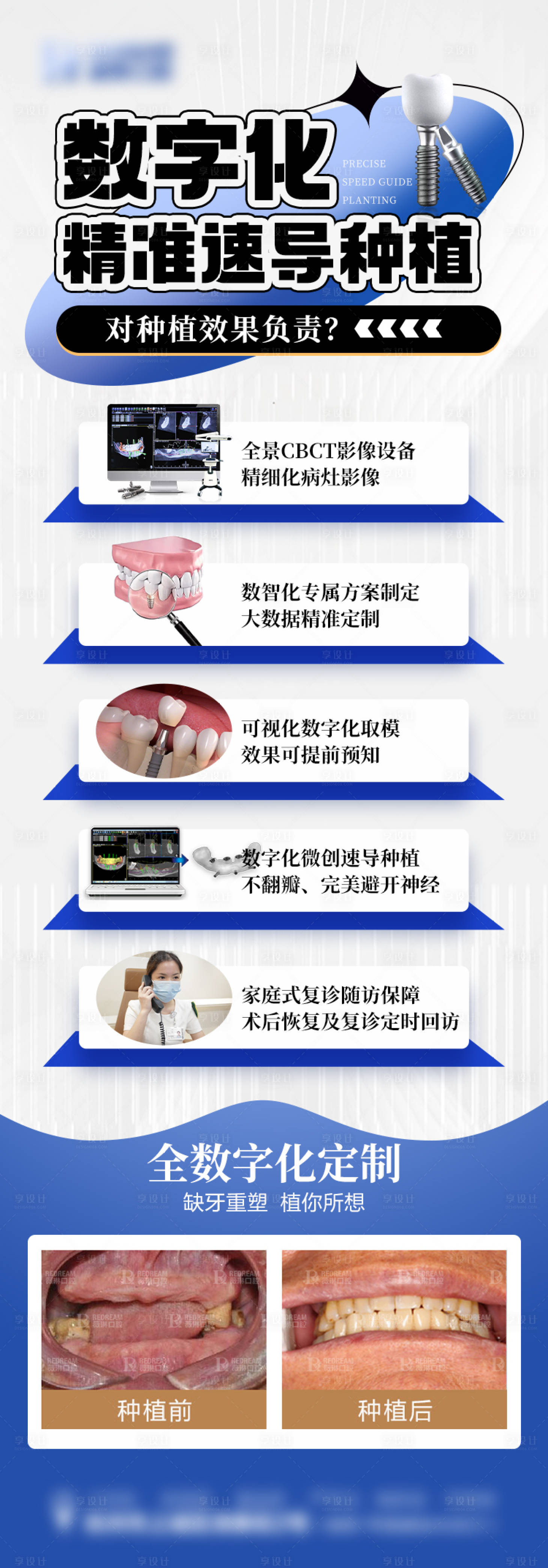 源文件下载【口腔种植牙长图海报】编号：20630019154367021
