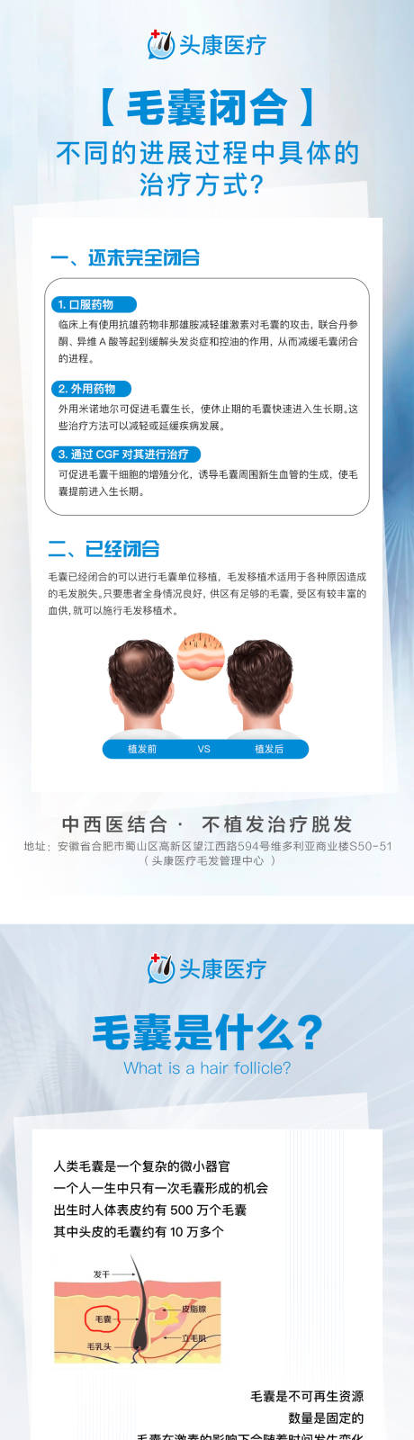 源文件下载【毛囊闭合科普海报】编号：64290019518752558
