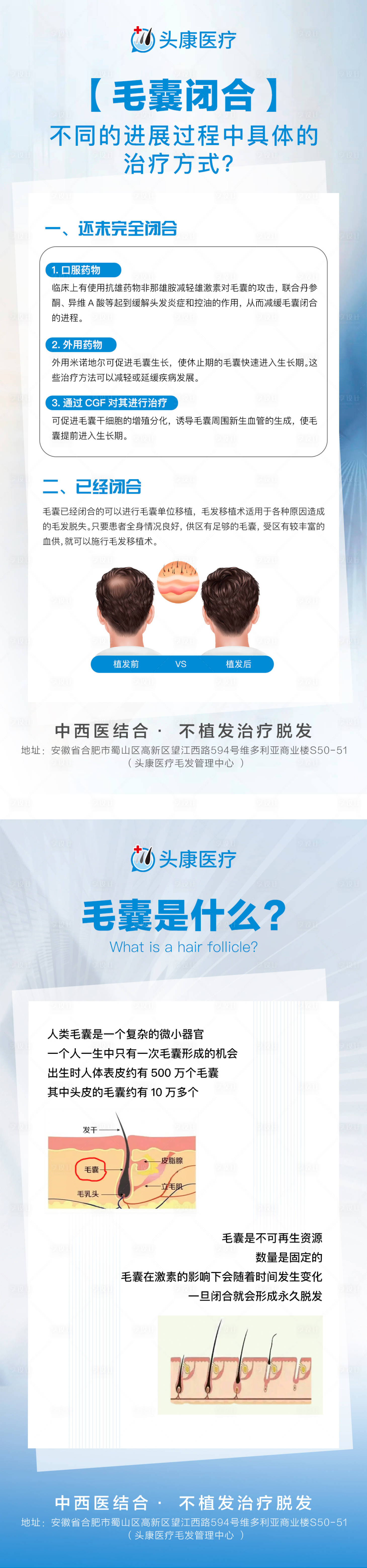 源文件下載【享設計】搜索編號：64290019518752558【毛囊閉合科普海報】