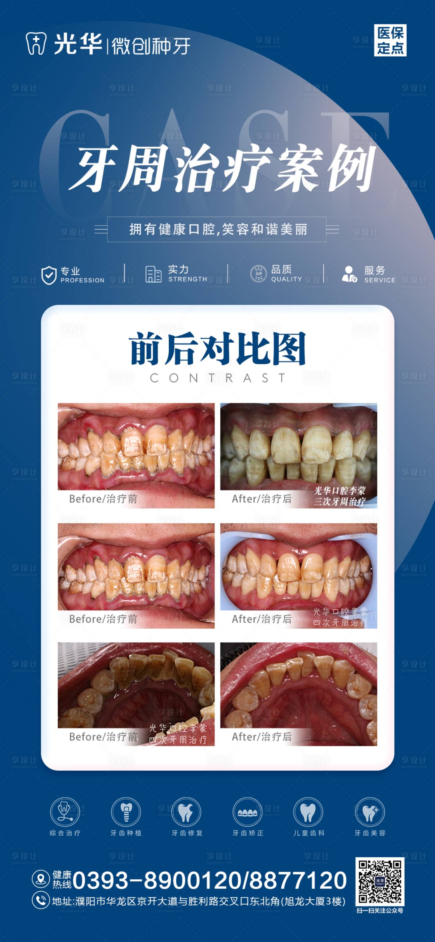 源文件下载【享设计】搜索编号：22420019233259990【口腔治疗案例对比海报】