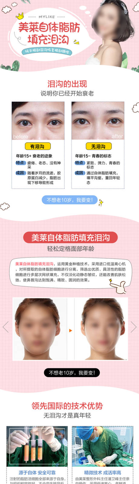 源文件下載【享設計】搜索編號：33170019328232925【醫美脂肪填充淚溝電商詳情頁】