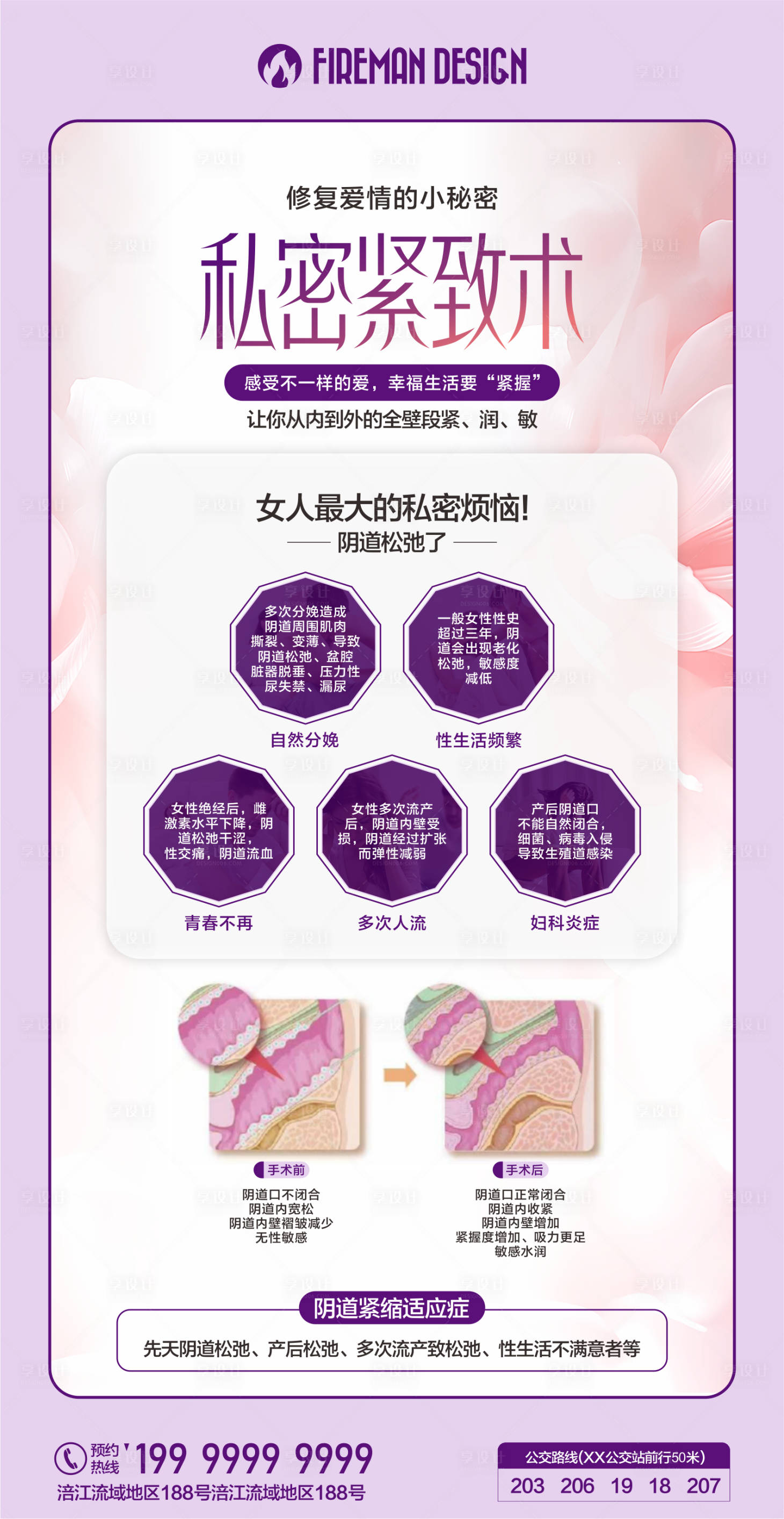 源文件下载【私密紧致术海报 】编号：24920019319261804