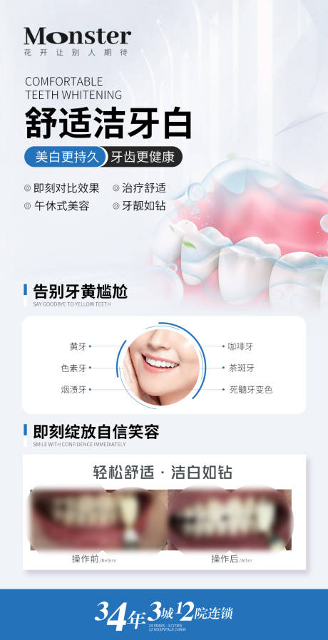 源文件下载【医美牙齿美白海报】编号：91000019324604025