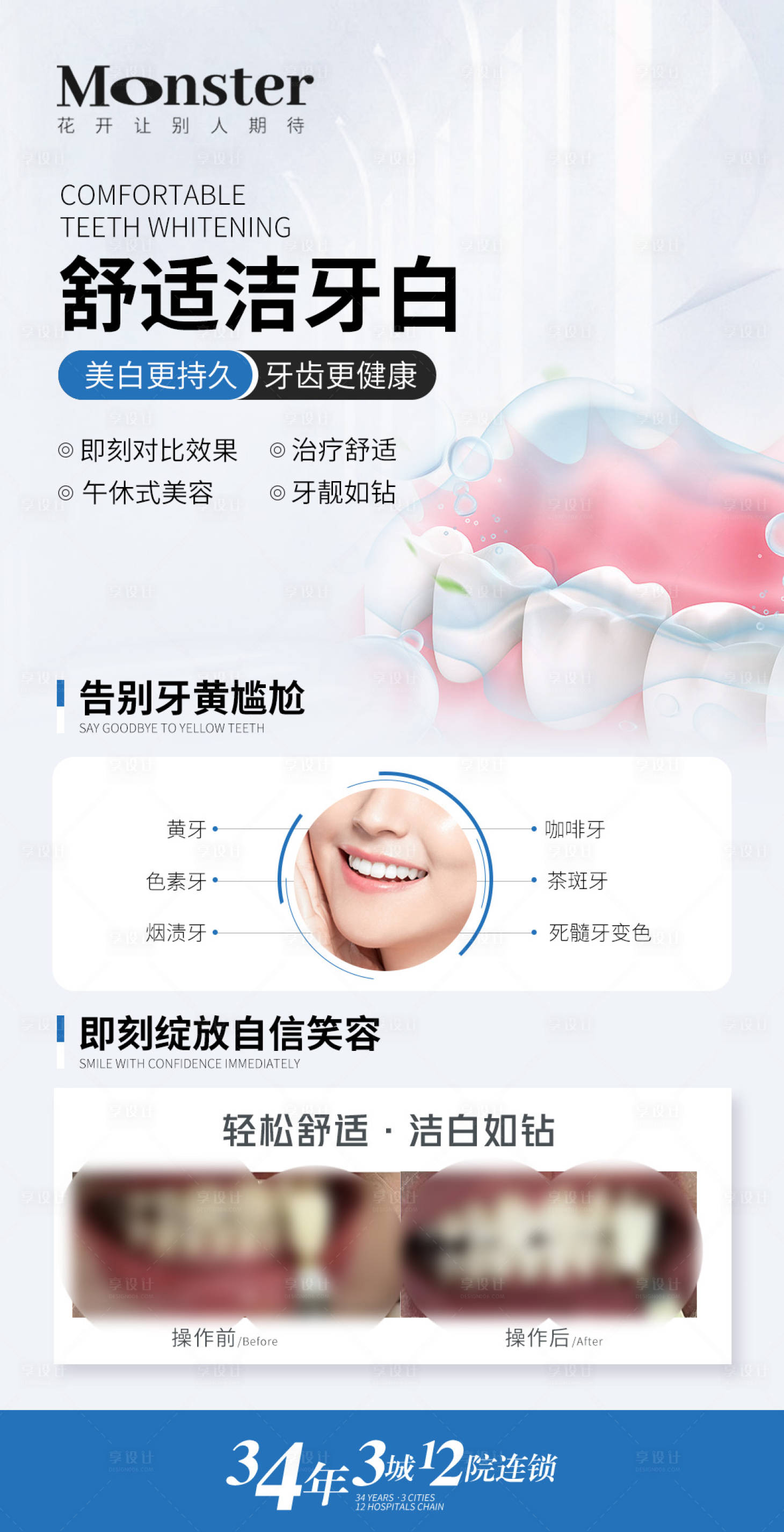 源文件下载【享设计】搜索编号：91000019324604025【医美牙齿美白海报】