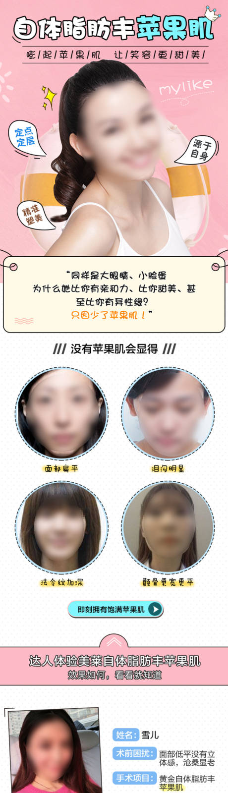 源文件下载【医美自体脂肪丰苹果肌详情页】编号：66730019327251971