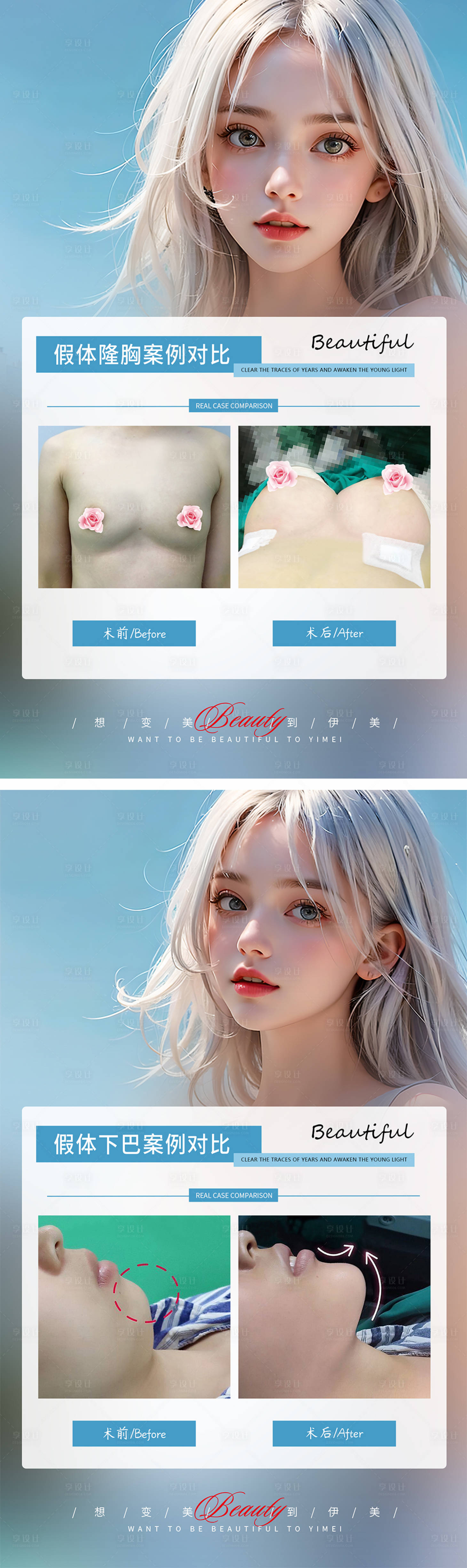 源文件下载【享设计】搜索编号：89740019384222323【隆胸丰下巴案例对比】
