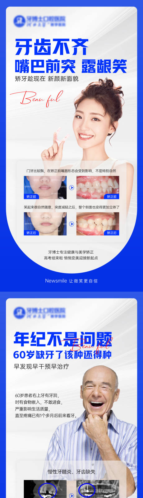 源文件下载【牙齿案例】编号：20230913164509857