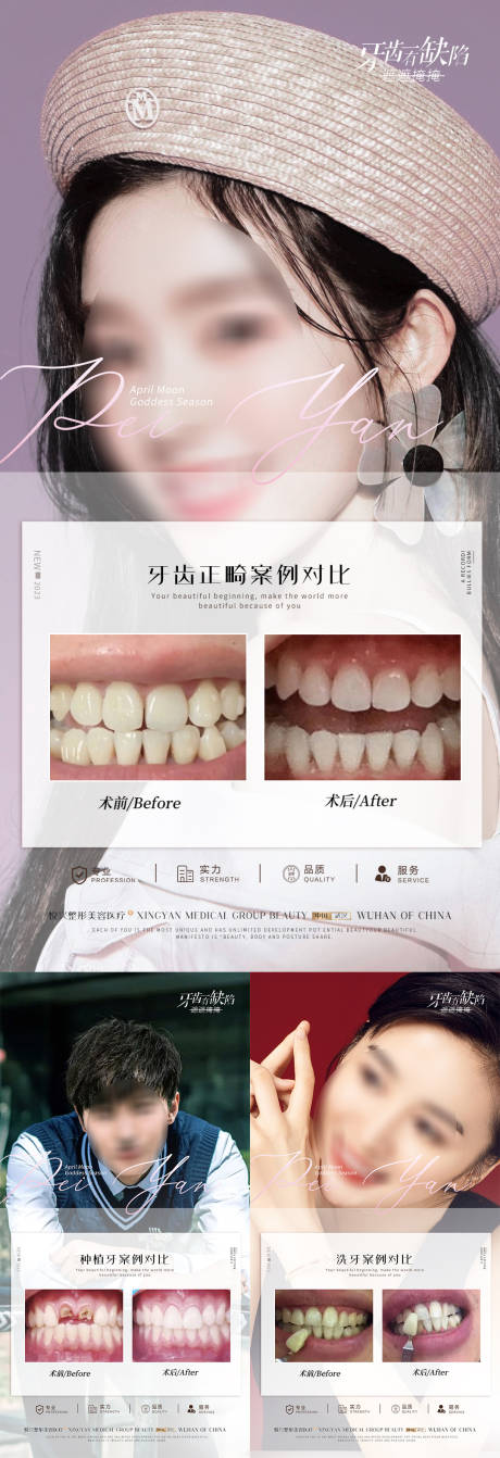 源文件下载【口腔简约案例对比系列海报】编号：45650019085705355