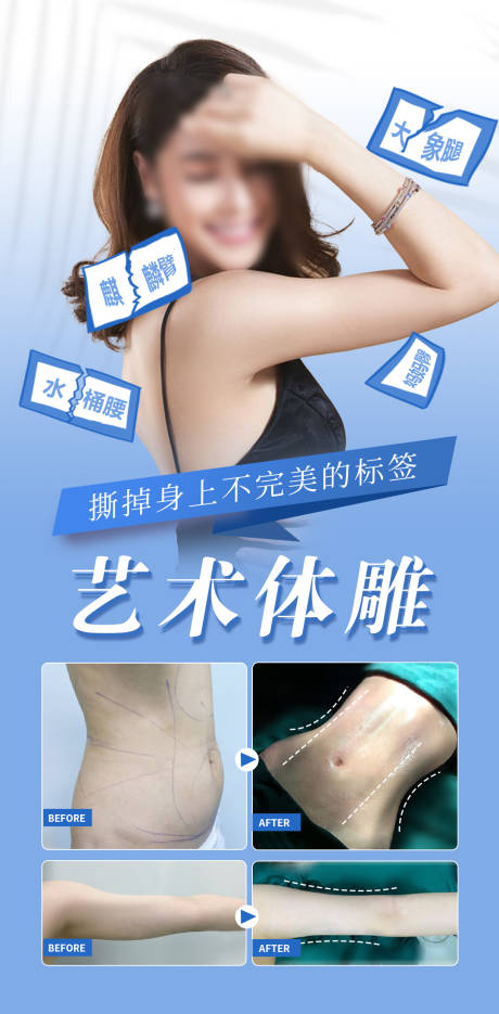 源文件下载【吸脂体雕塑形案例医美海报】编号：81190019497248471