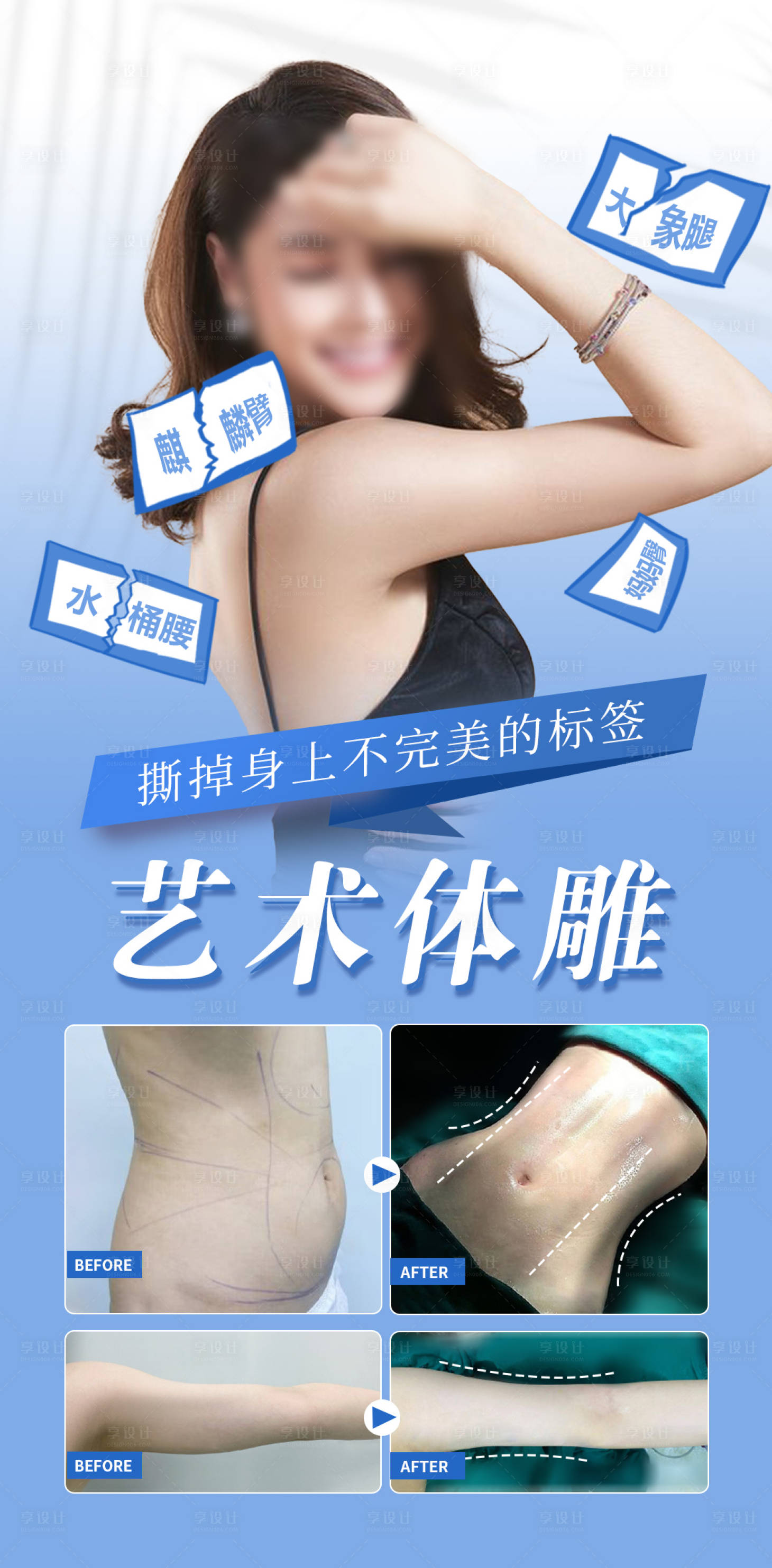 源文件下載【享設計】搜索編號：81190019497248471【吸脂體雕塑形案例醫美海報】
