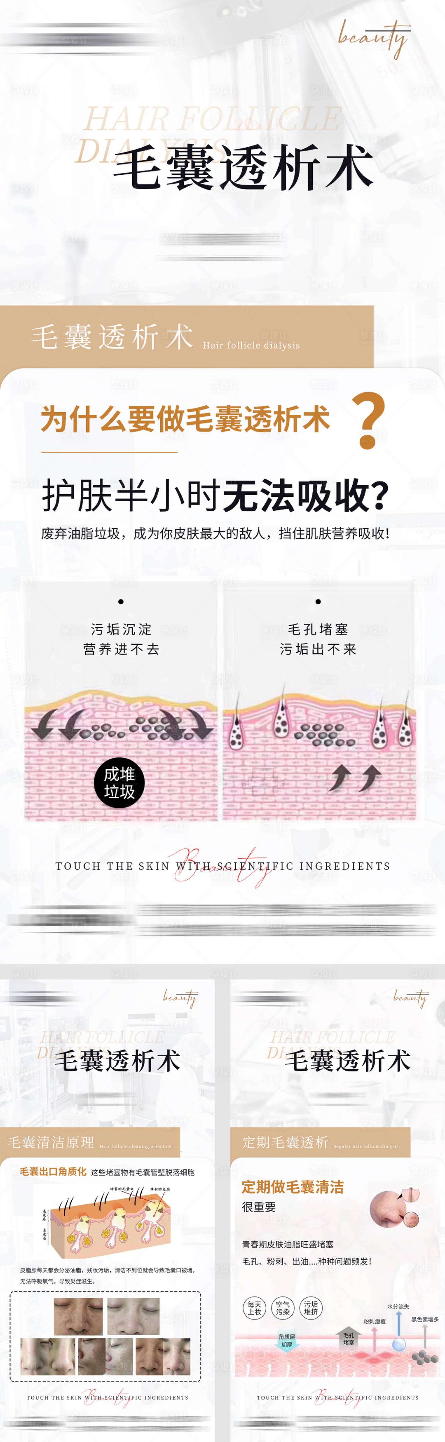 源文件下載【灰色系醫美毛囊透析術知識科普】編號：53940019559102345