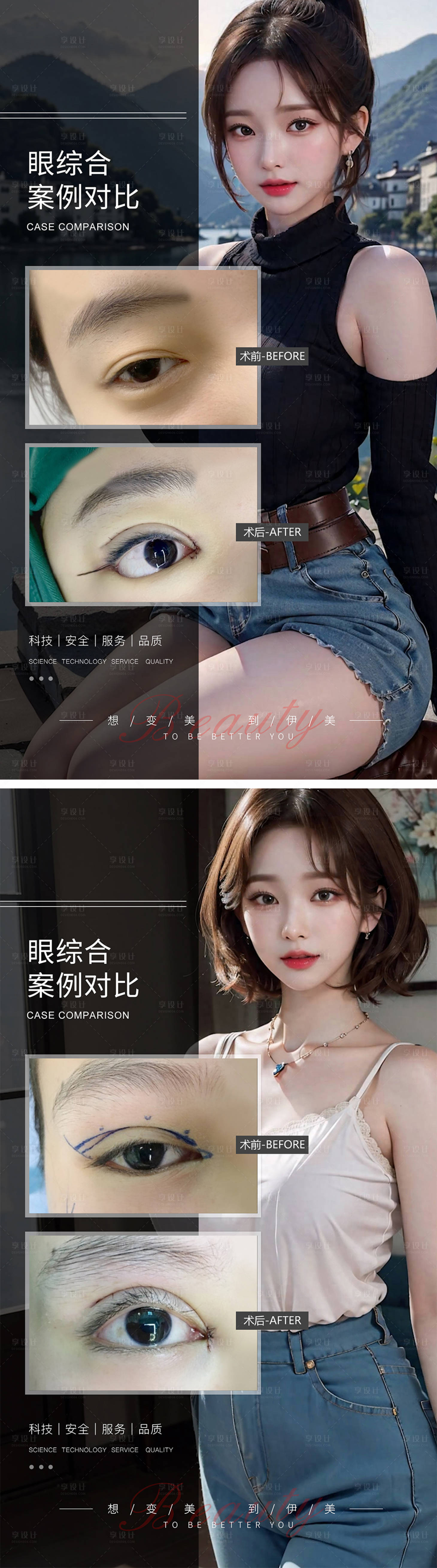 源文件下載【享設計】搜索編號：32080019334224453【眼綜合案例對比】