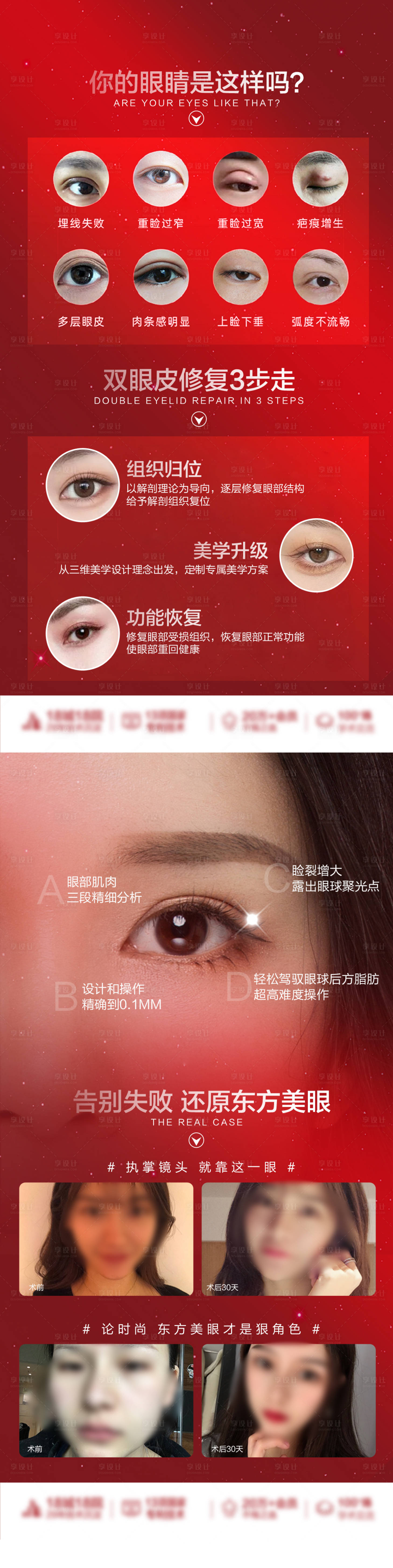 源文件下載【享設計】搜索編號：37530019519784355【雙眼皮小知識海報】