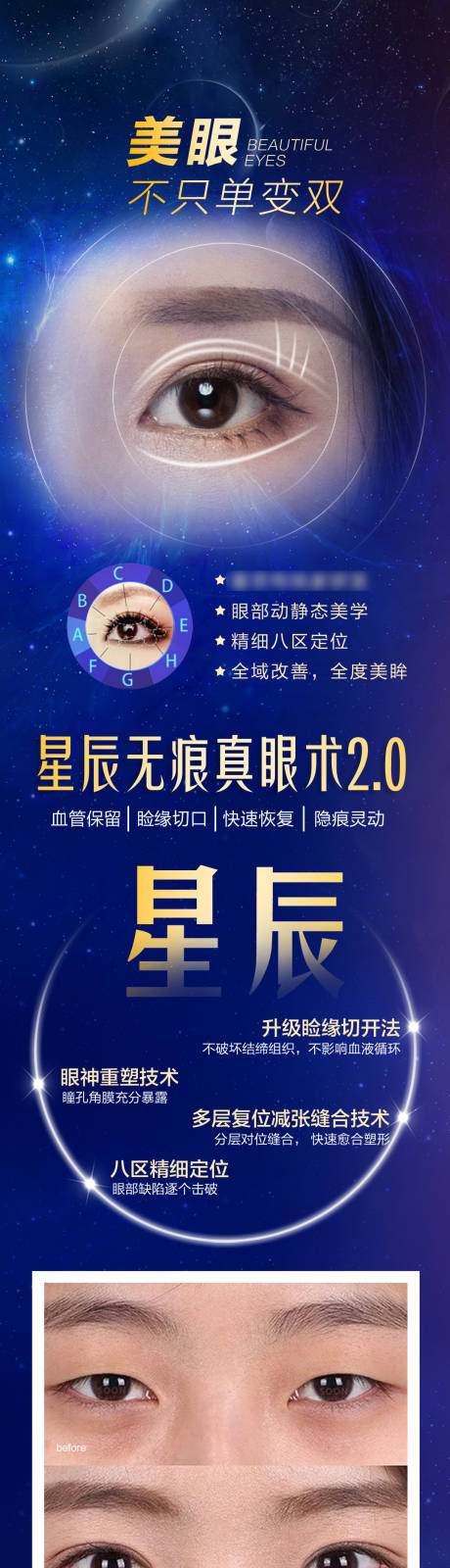 源文件下载【无痕双眼皮长图】编号：56940019458041317