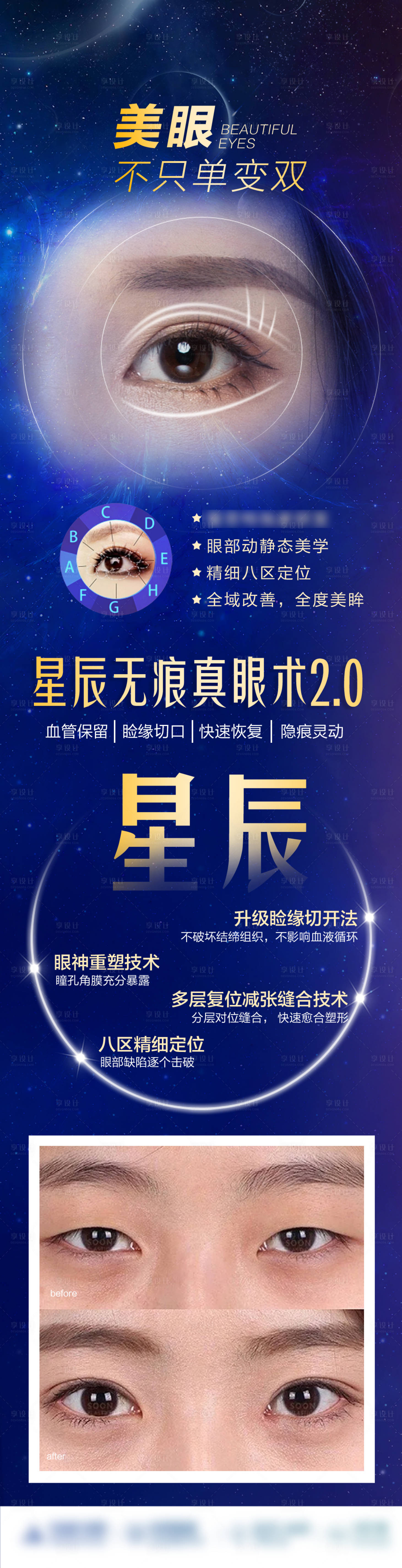 源文件下载【享设计】搜索编号：56940019458041317【无痕双眼皮长图】