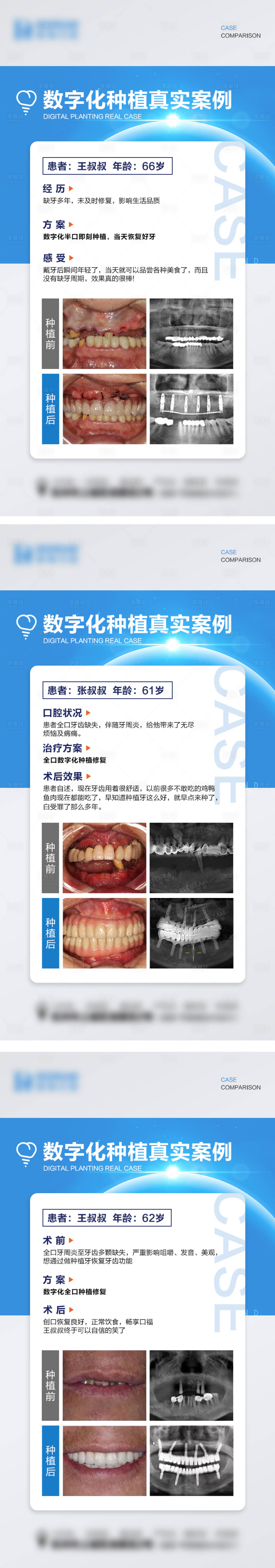 源文件下载【享设计】搜索编号：58230019326105789【口腔种植牙】